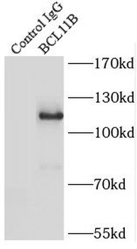 BCL11B Antibody