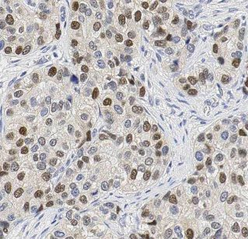 BCL2L12 Rabbit Polyclonal Antibody