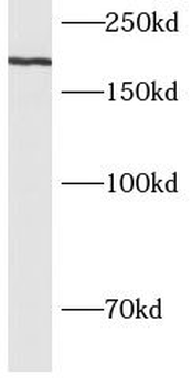 BCOR Rabbit Polyclonal Antibody
