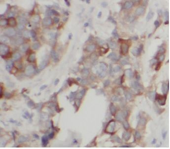 ABCG2 Antibody