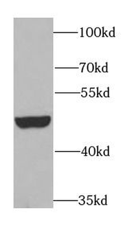 BCS1L Rabbit Polyclonal Antibody