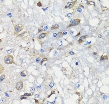 BCS1L Rabbit Polyclonal Antibody