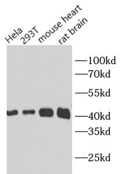 beta actin Rabbit Polyclonal Antibody