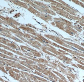 beta actin Rabbit Polyclonal Antibody