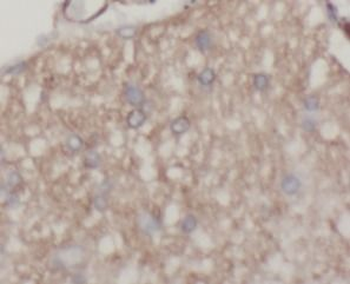 Beta Tubulin Antibody