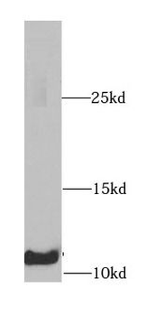B2M Rabbit Polyclonal Antibody