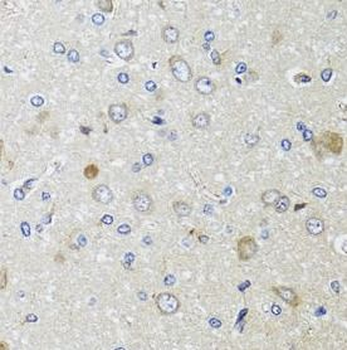 B2M Rabbit Polyclonal Antibody