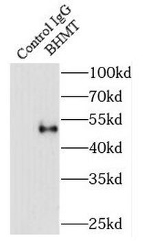 BHMT Rabbit Polyclonal Antibody