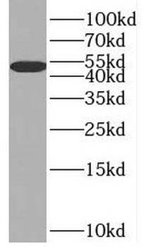 BHMT Rabbit Polyclonal Antibody