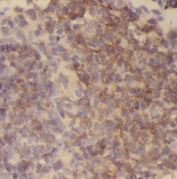 BHMT Rabbit Polyclonal Antibody