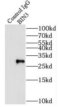 BIN3 Rabbit Polyclonal Antibody