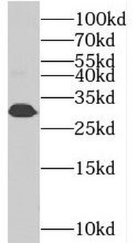 BIN3 Rabbit Polyclonal Antibody
