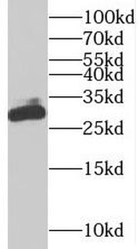 BIN3 Rabbit Polyclonal Antibody