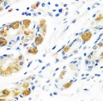 BLVRB Rabbit Polyclonal Antibody