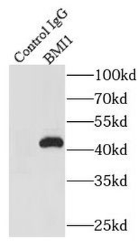 BMI1 Mouse Monoclonal Antibody