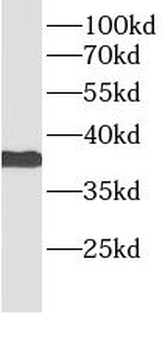BMI1 Mouse Monoclonal Antibody