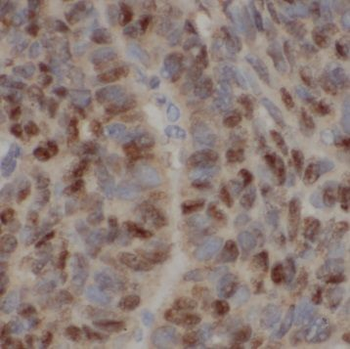 BMI1 Mouse Monoclonal Antibody