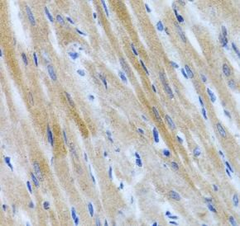 BMP3 Rabbit Polyclonal Antibody