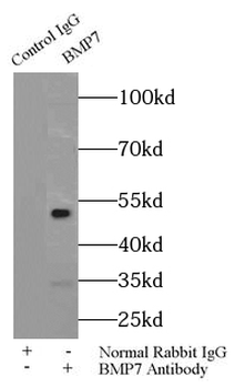 BMP7 Rabbit Polyclonal Antibody