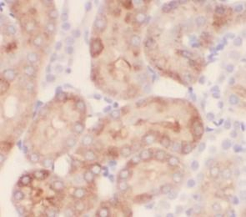 BMP7 Rabbit Polyclonal Antibody