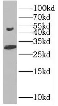 GDF2 Antibody