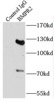 BMPR2 Rabbit Polyclonal Antibody