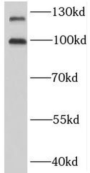 BMPR2 Rabbit Polyclonal Antibody