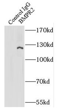 BMPR2 Rabbit Polyclonal Antibody