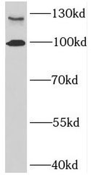 BMPR2 Rabbit Polyclonal Antibody