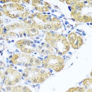 BNIP3L Antibody