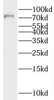 CTCFL Rabbit Polyclonal Antibody