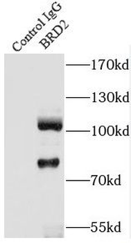 BRD2 Rabbit Polyclonal Antibody
