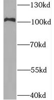 BRD2 Rabbit Polyclonal Antibody
