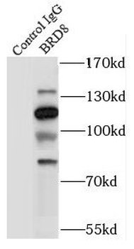 BRD8 Rabbit Polyclonal Antibody