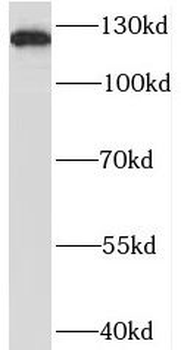 BRD8 Rabbit Polyclonal Antibody