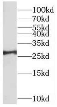 BRMS1 Rabbit Polyclonal Antibody