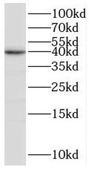 BRMS1L Antibody