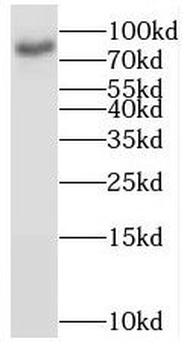 BRSK1 Rabbit Polyclonal Antibody