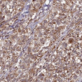 BRSK1 Rabbit Polyclonal Antibody