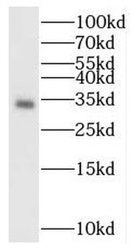 BST2 Rabbit Polyclonal Antibody