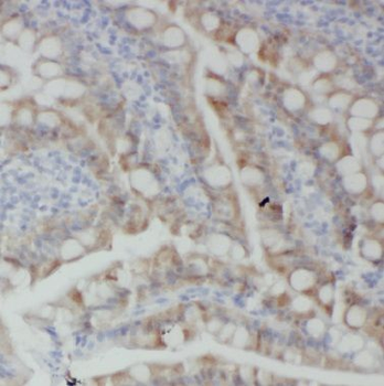 BTG2 Rabbit Polyclonal Antibody