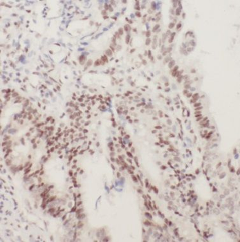 BUB1B Antibody