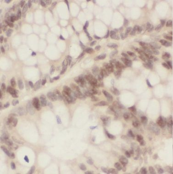 BUD31 Rabbit Polyclonal Antibody