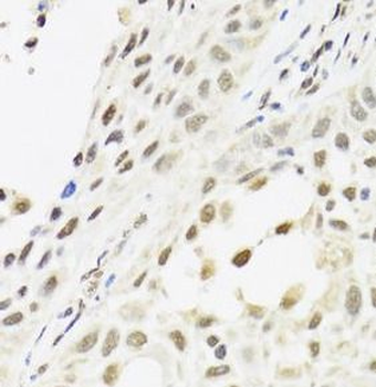 RTRAF Rabbit Polyclonal Antibody