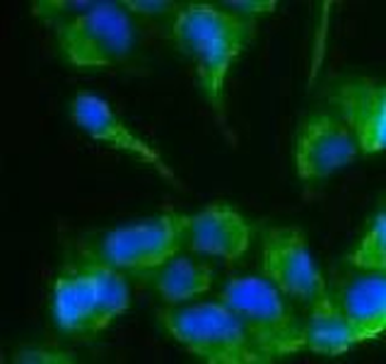 C1R Rabbit Polyclonal Antibody