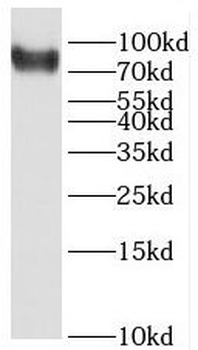 C1S Rabbit Polyclonal Antibody
