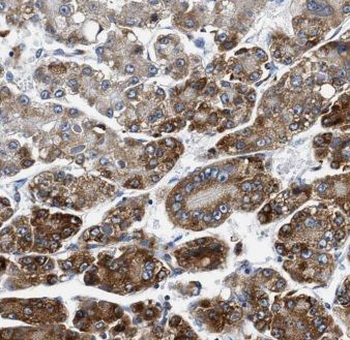 C1S Rabbit Polyclonal Antibody