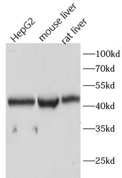 C4BPB Rabbit Polyclonal Antibody