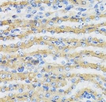 C4BPB Rabbit Polyclonal Antibody