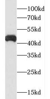 C5AR1 Rabbit Polyclonal Antibody
